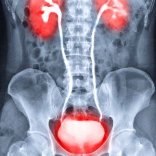 Ochrona dróg moczowych